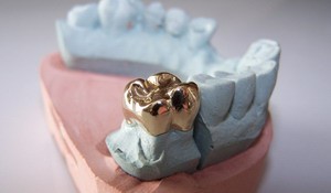 Coroana totala din aur