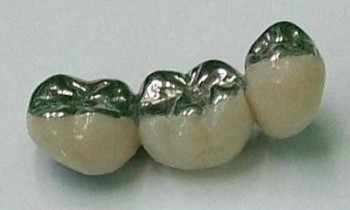 Corona semifizionomica tip Weiser