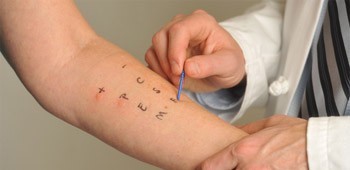 Implantul dentar poate declansa reactii alegice?