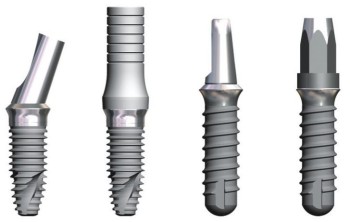 Ce este implantul dentar?
