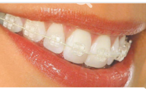 Jescala Art Dent - Dental Clinic